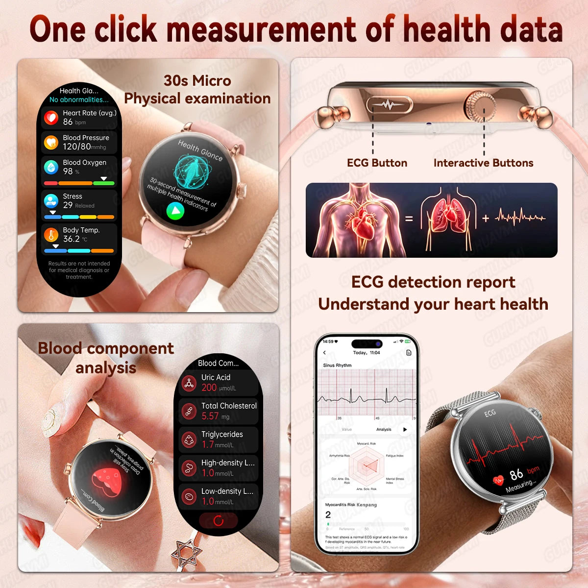 2026 New Women Health Smartwatch 1.32-Inch AMOLED Screen ECG Blood Pressure Body Fat Heart Rate Bluetooth Call Ladies Smartwatch
